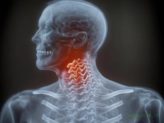 颈椎病增生怎么治最好,颈椎病增生是什么意思