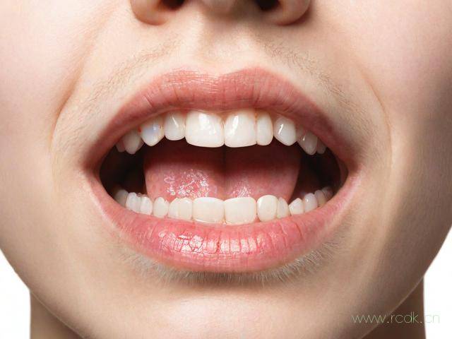 口腔念珠菌病怎么治疗,念珠菌自愈的最佳方法