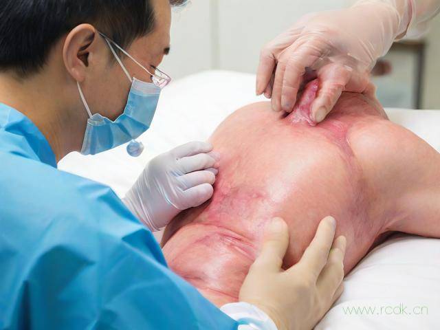 沈阳怎么治疗皮肤病,沈阳怎样治皮肤病