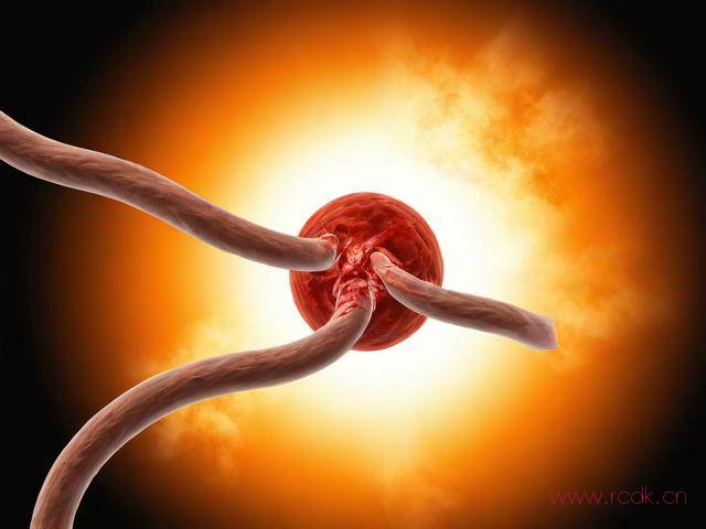 眼底病怎么治,眼底病怎么治疗血管弯曲属于严重吗