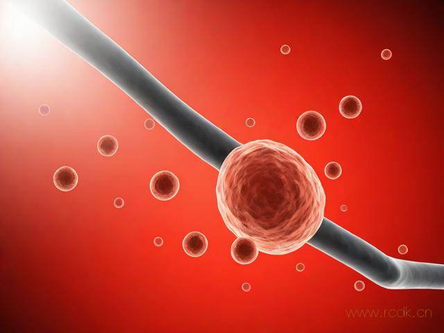 糖尿病是怎么样引起的,糖尿病是怎样得的病因